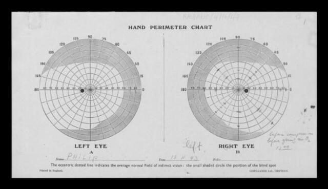 Eye chart created by Ursula Philip